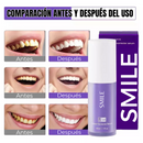 Blanqueador Dental
