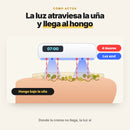 La luz atraviesa la uña y llega al hongo